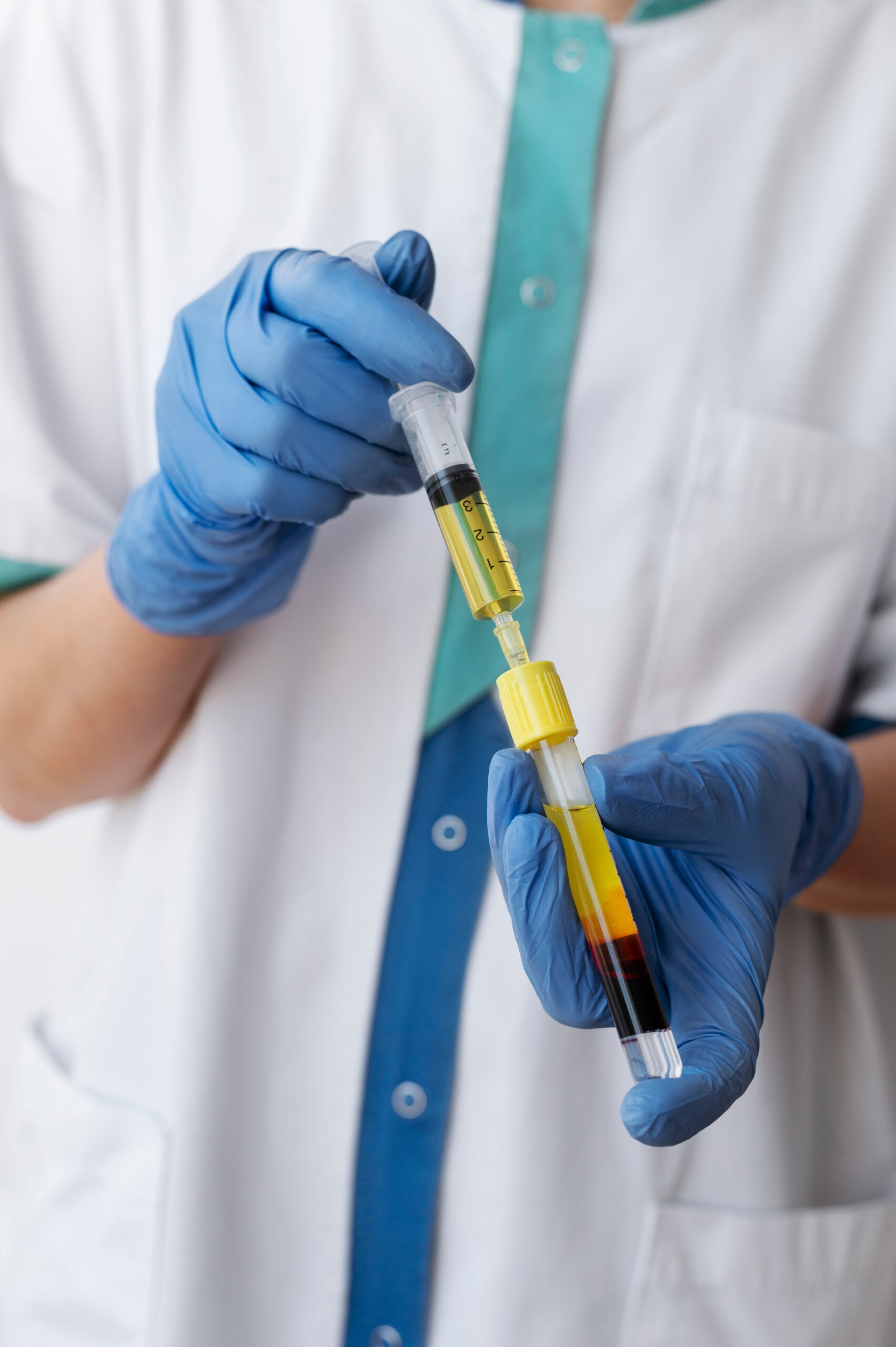 prp syringe