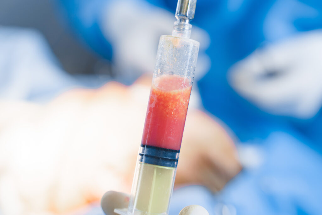 BMA syringe