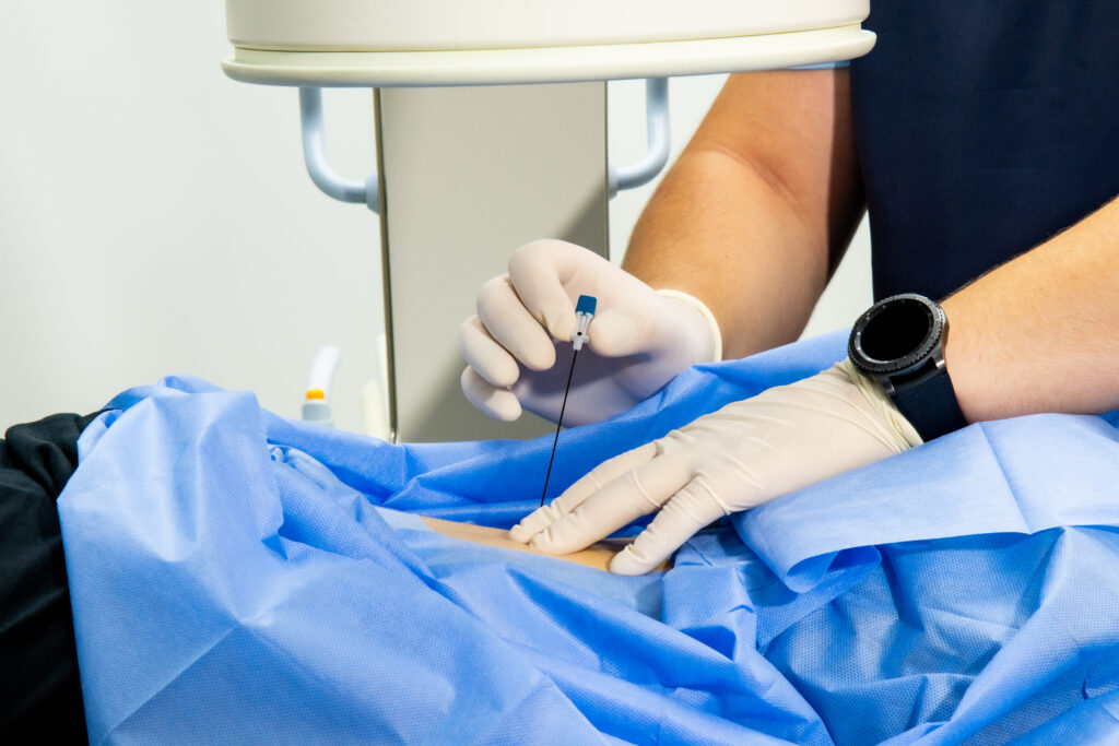 fluoro spine procedure