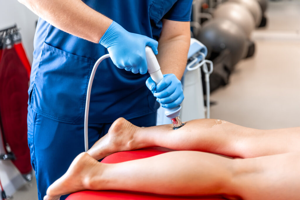 Shock wave therapy Achilles